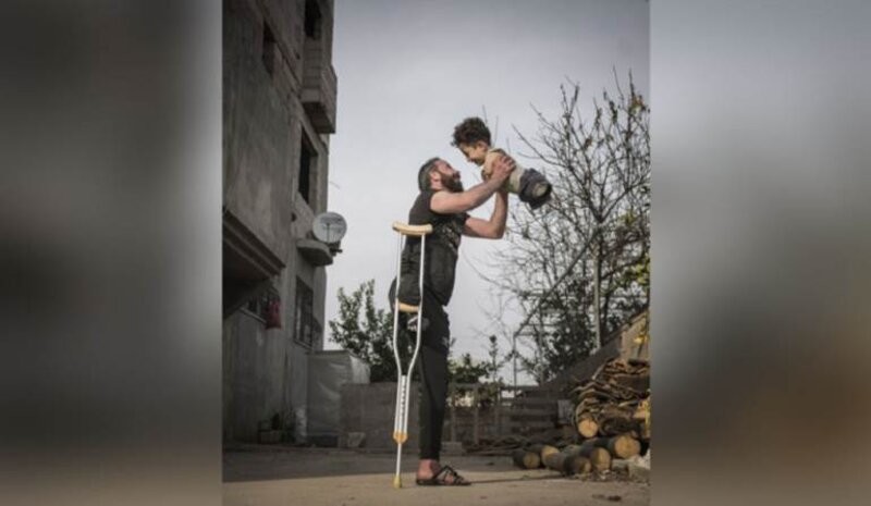 صورة العام… أب سوري بساق مبتورة يحمل إبناً بلا أطراف
